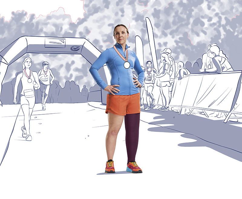 Angharad has lymphedema and wears new JOBST Confidence. Angharad has lymphedema and wears new JOBST Confidence.